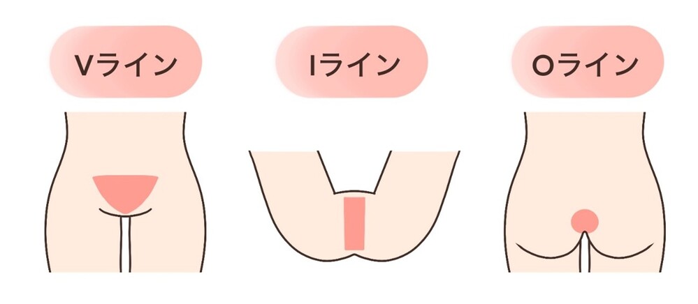 かなでる女性クリニック日野の医療脱毛はのイメージ画像